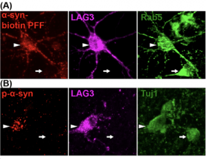  Dopamine neurons derived from iPSCs from the lab of Xiaobo Mao, PhD